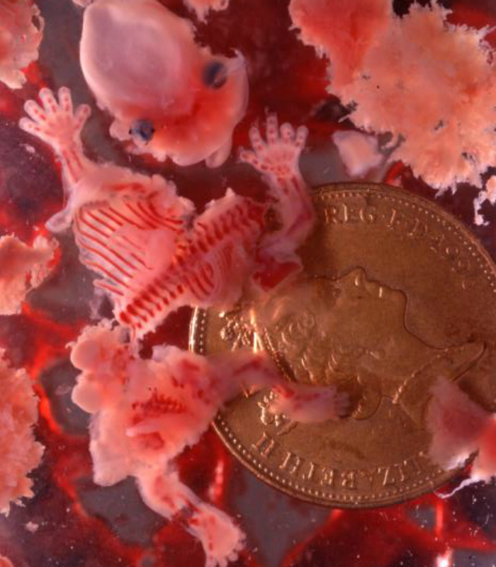 An 8-week-old aborted baby.