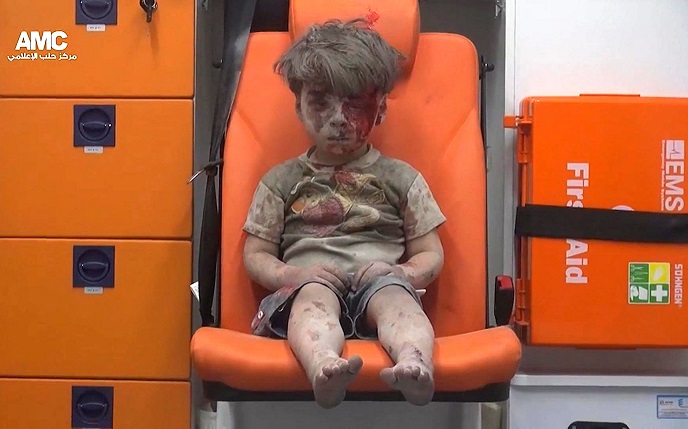 Five-year-old Omran Daqneesh, rescued in Aleppo. See credits below.