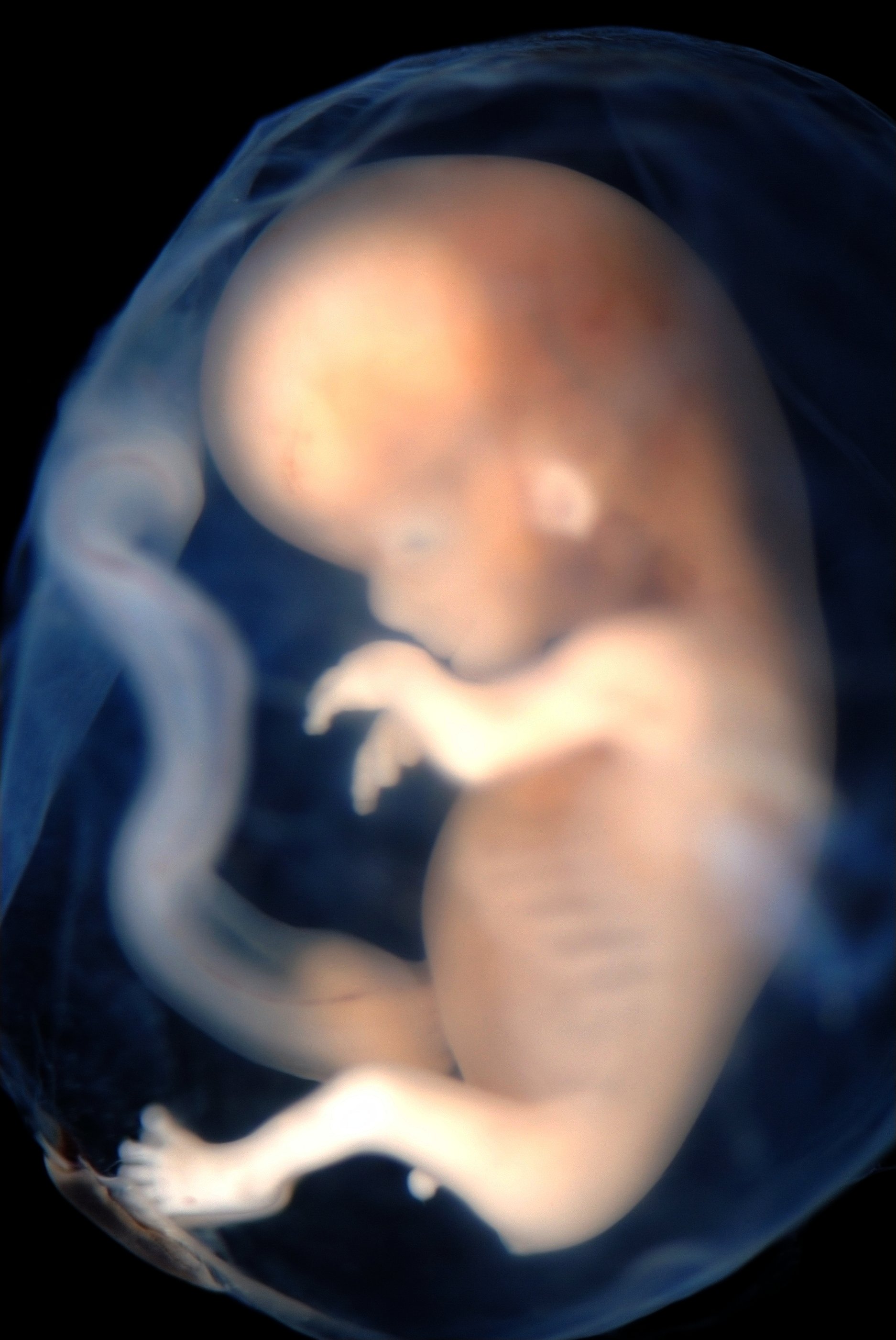 Embryo age 9 - 10 weeks / See Credits