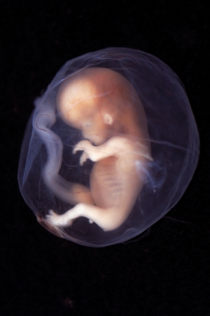 50 Years, 8,700,000 Lives
