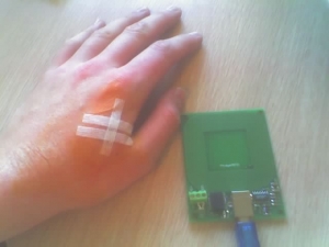 Microchip implant